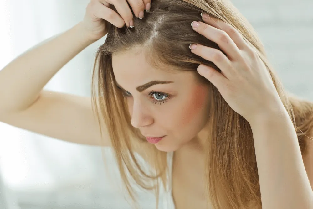 HAIR LOSS TREATMENTS in dubai