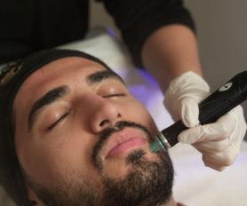 علاج هايدرافيشال: كل ما تحتاجين معرفته قبل حجز جلستك الأولى